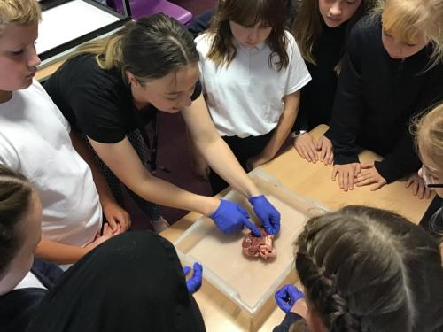 Y6-disecting-the-heart-2jpg